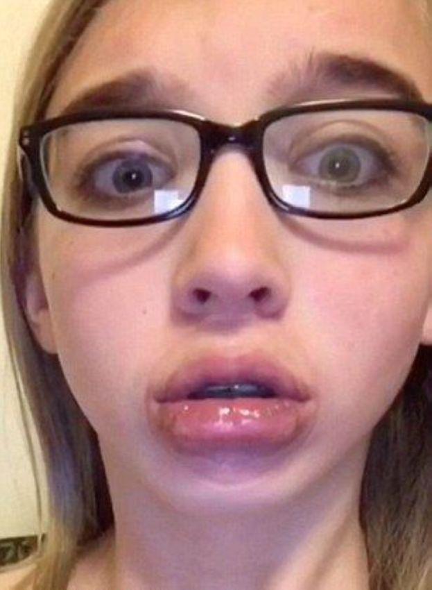 Autors: matilde Bezmaksas lūpu palielināšana: Šokējoši rezultāti!