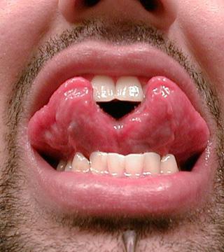 Tā sauktā Snake tongue jeb... Autors: Nilsons15 Body Modifications - Ķermeņa modifikācijas?! (1. daļa)