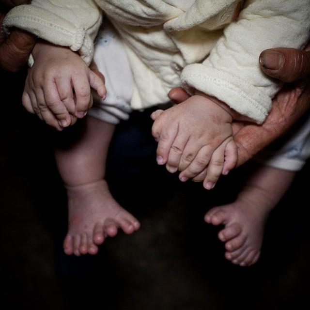 Scaronim mazulim ir 15... Autors: matilde Cilvēki dalās ar fotogrāfijām, kurās redzamas viņu dīvainākās ķermeņa daļas