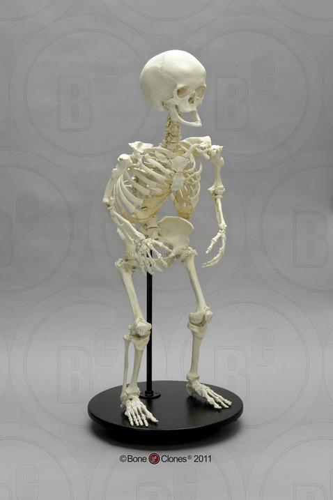 Pundura skelets Par... Autors: The Diāna Izglītojoši: Neparasti skeleti, kuri ilustrē slimības un procesus