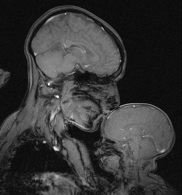 Sieviete ar bērnu Autors: Lestets 15 rentgenuzņēmumi, kas atklās par ķermeni vairāk nekā anatomijas grāmatas