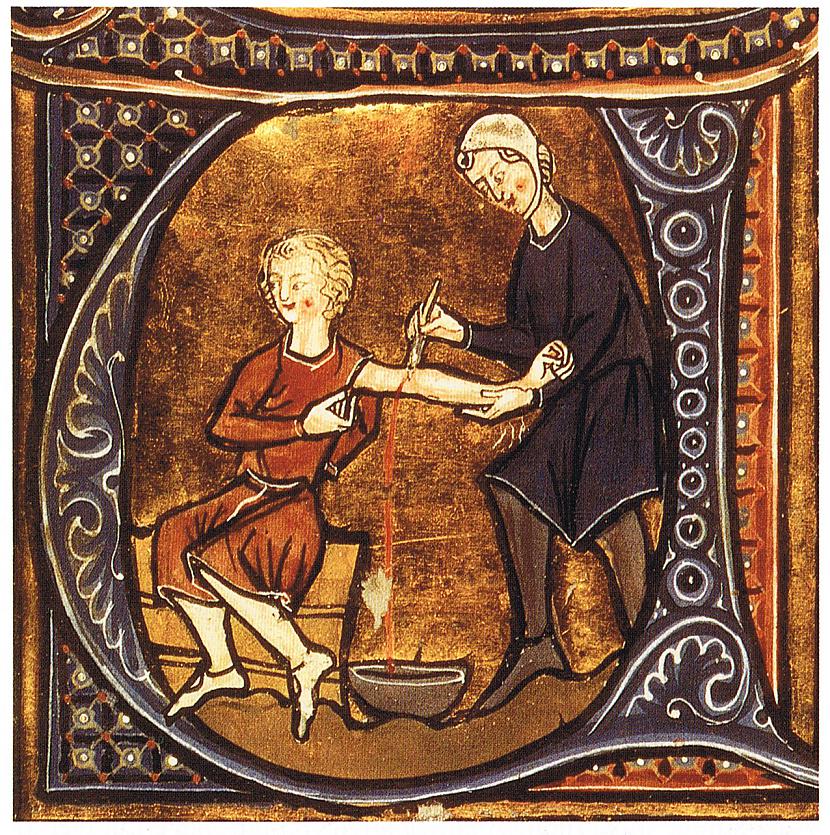 Asins noliescaronanaDaudzi... Autors: Artemiis Ļoti DĪVAINAS ārstniecības metodes vēsturē