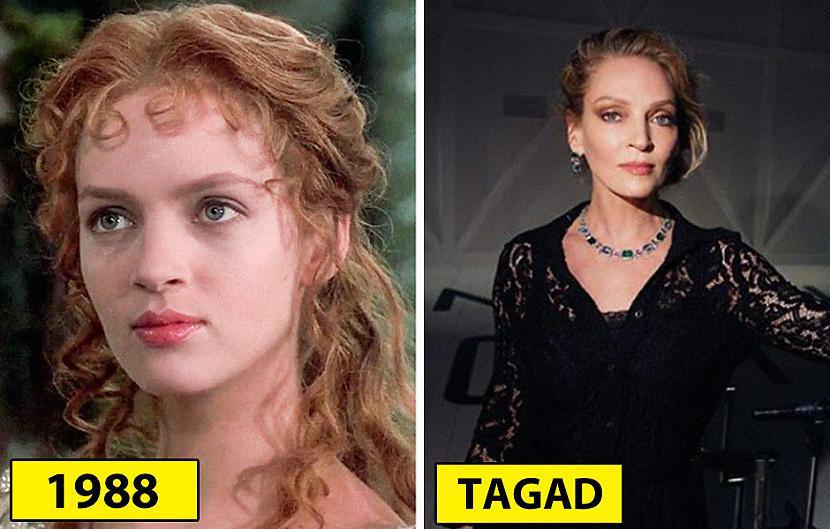 Uma Tūrmane Autors: matilde Kā izskatījās aktieri savas karjeras sākumā un kā viņi izskatās tagad