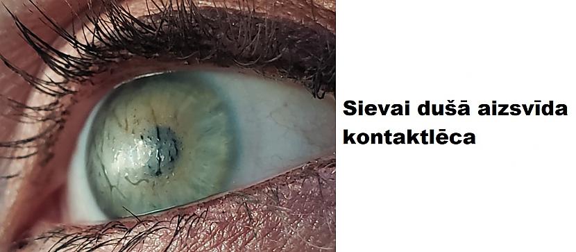 Autors: The Diāna 20 attēli, kas izskatās viltoti, bet ir īsti